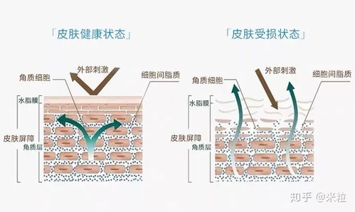 可愈類人膠原蛋白修復敷料 技術與肌膚修復的科學之道